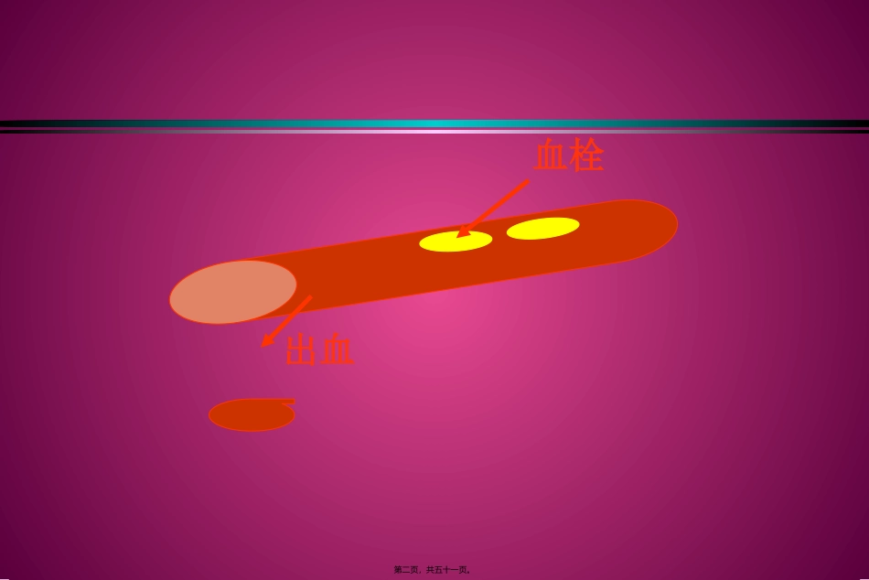 血栓与止血 医学教学课件_第2页