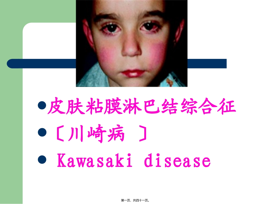 川崎病皮肤粘膜淋巴结综合征 医学培训讲座课件_第1页