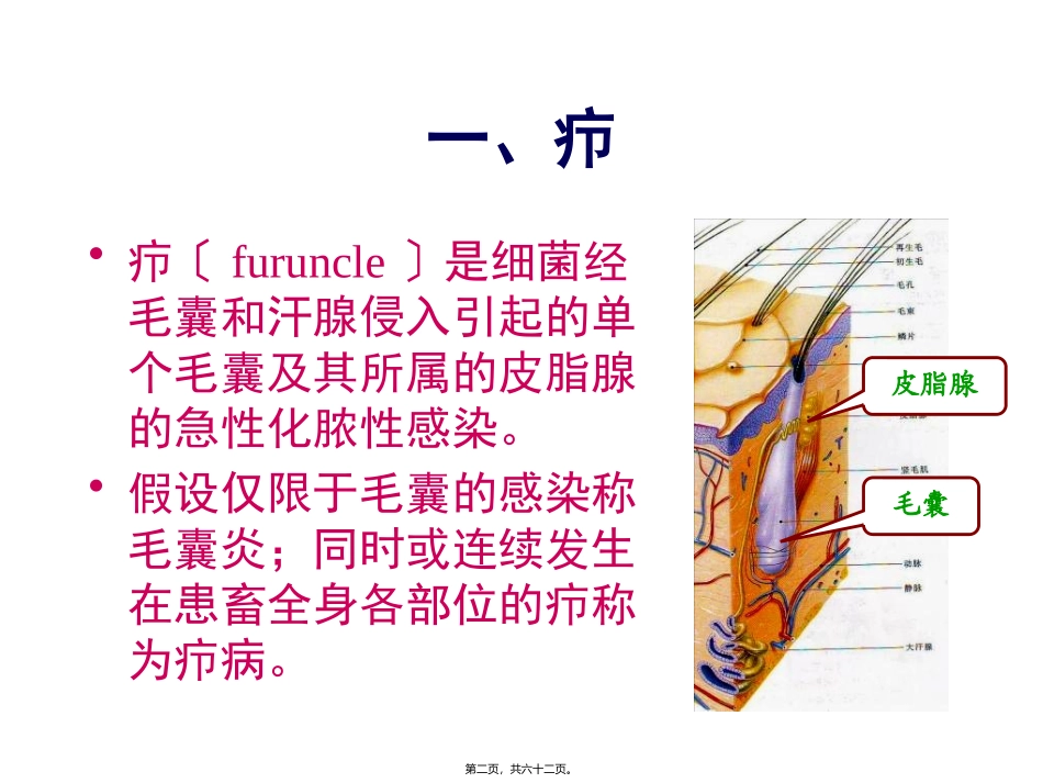 医学教学课件 第二章外科局部感染_第2页
