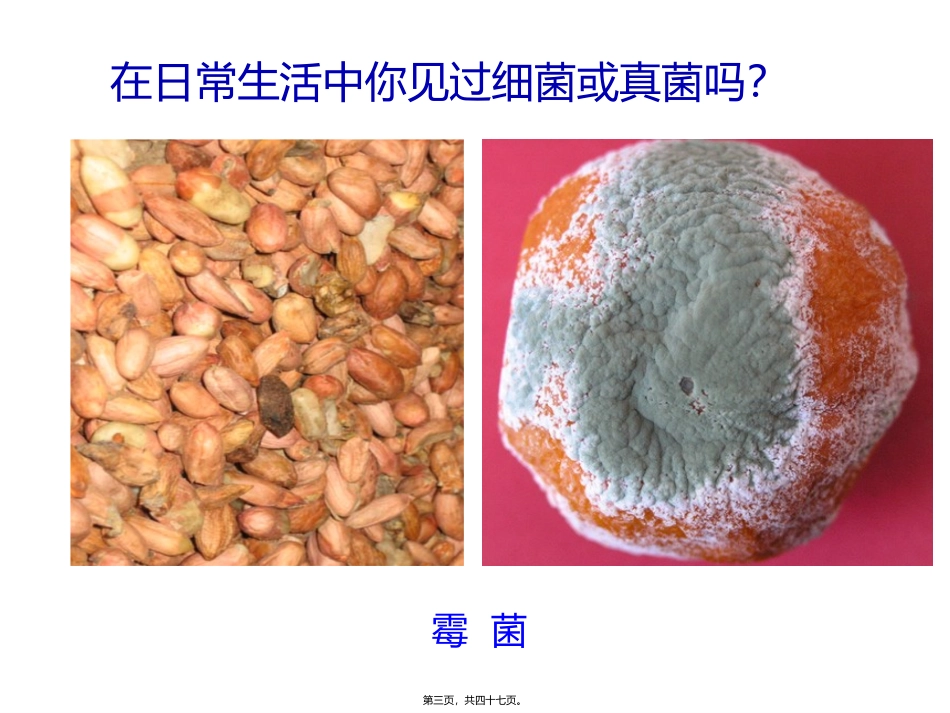 医学课件 细菌和真菌的分布_第3页