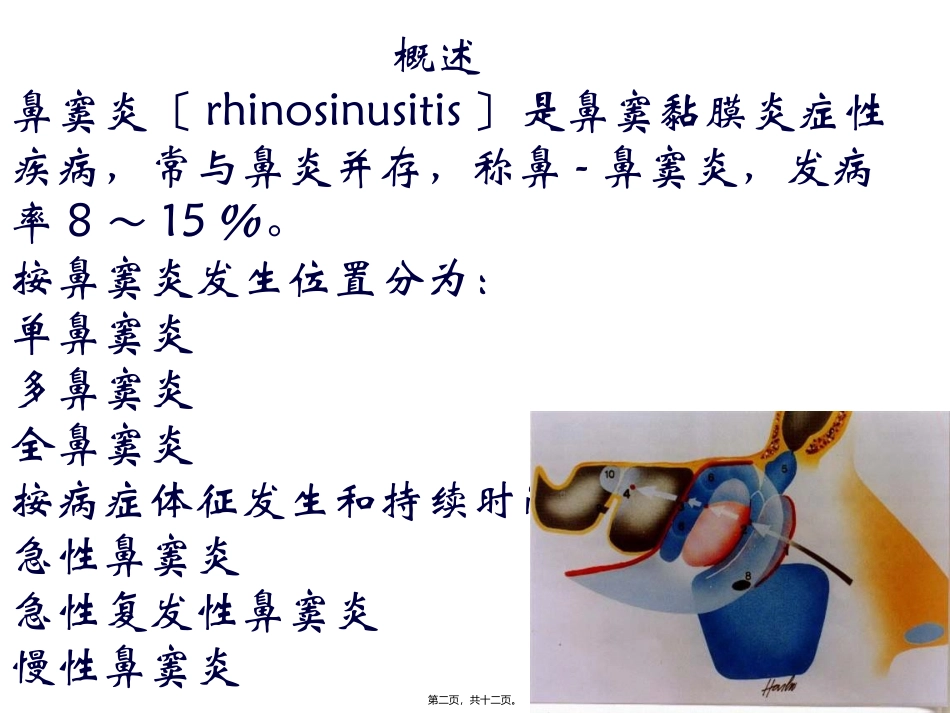 医学培训课件 鼻窦炎_第2页