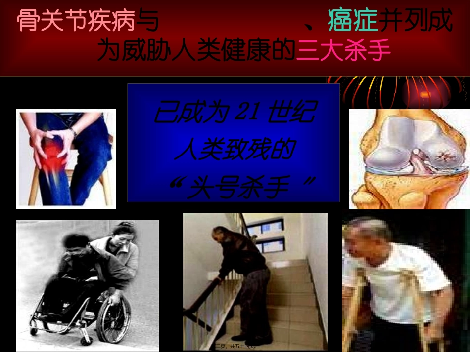 不死的癌症-骨关节病_第2页