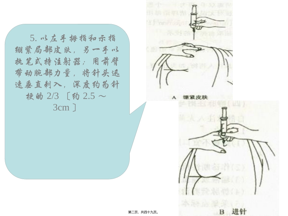 以左手拇指和示指绷紧局部皮肤另一手以执笔式持注射器微粒  医学教学课件_第1页