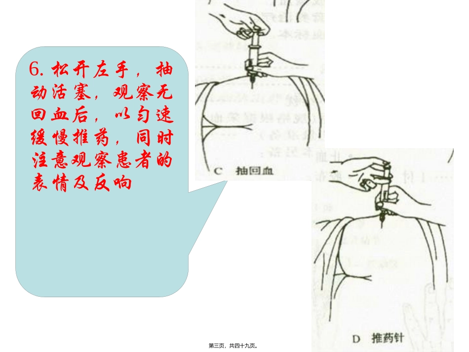 以左手拇指和示指绷紧局部皮肤另一手以执笔式持注射器微粒  医学教学课件_第2页