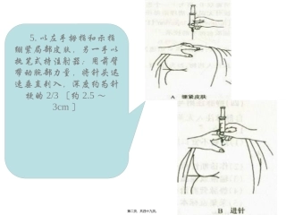以左手拇指和示指绷紧局部皮肤另一手以执笔式持注射器微粒  医学教学课件