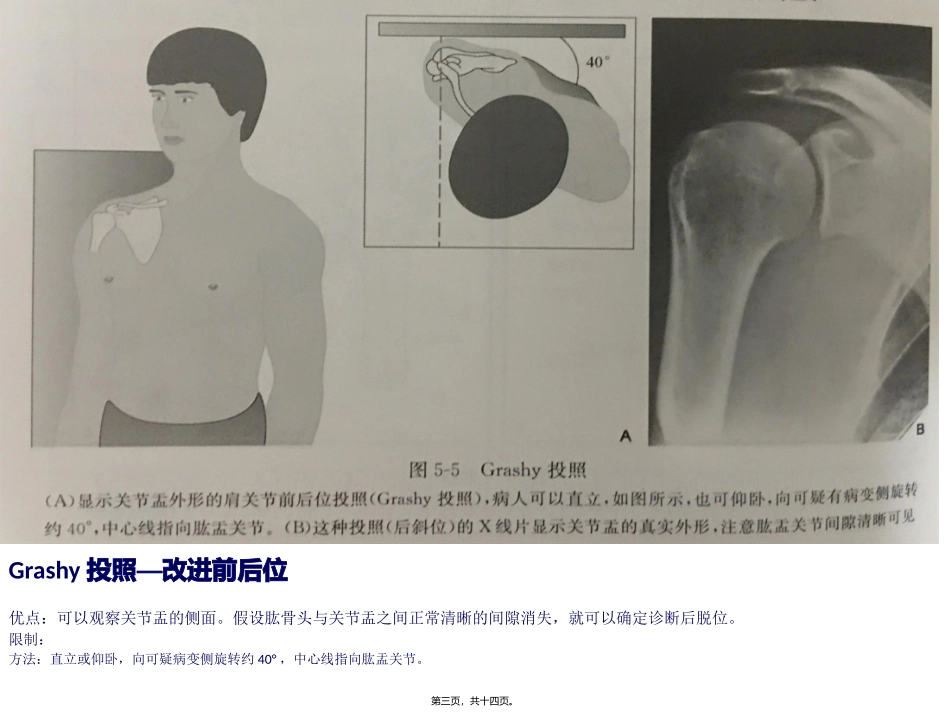 不同肩关节X线投照位_第3页