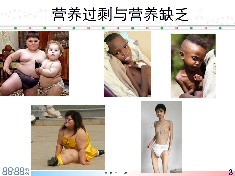 营养风险筛查与评估讲座课件_第3页