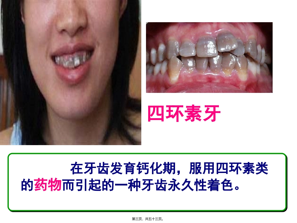 8.2-用药与急救_第3页