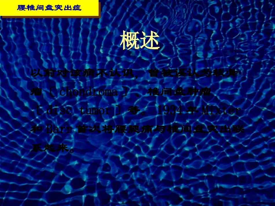 椎间盘突出症医学教学课件_第3页