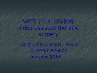 VATS肺叶切除