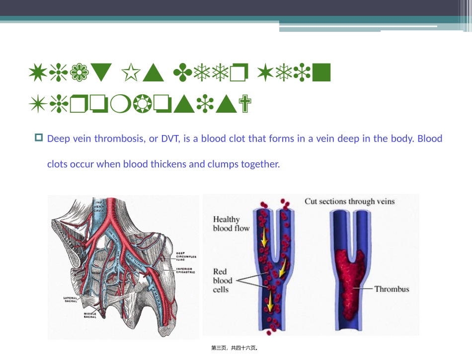 Deep-vein-thrombosis深静脉血栓_第3页