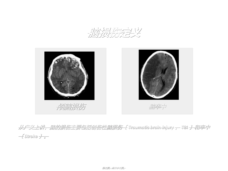 NGF与认知功能障碍_第2页