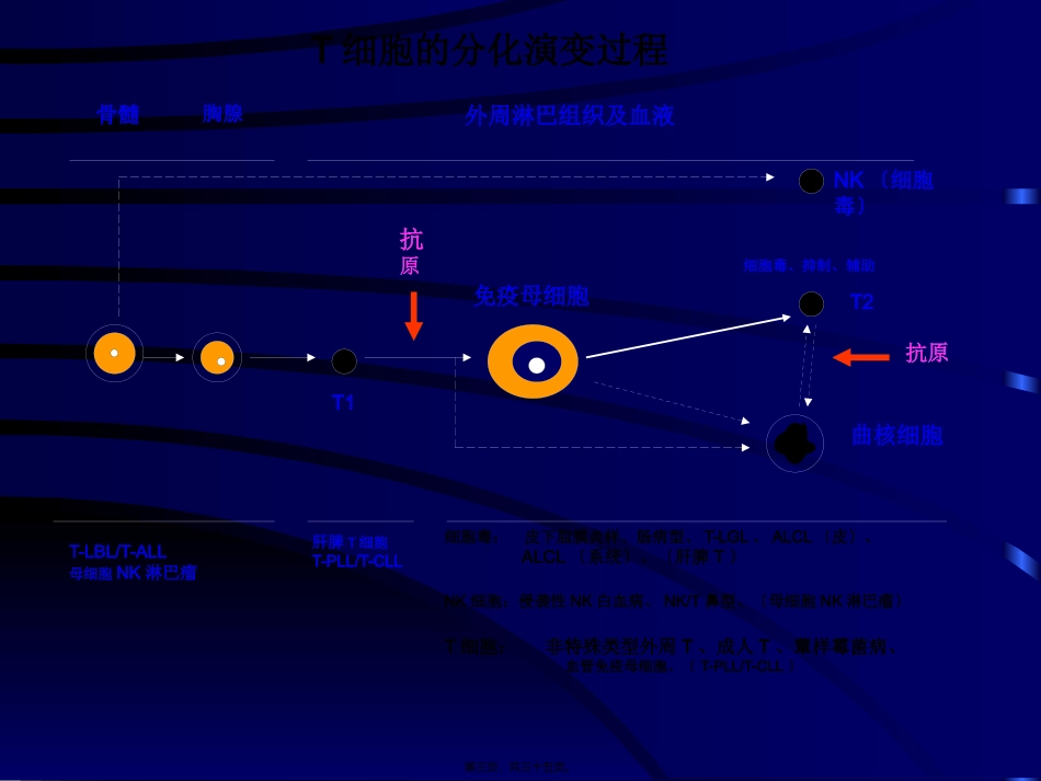 NKT细胞淋巴瘤_第3页