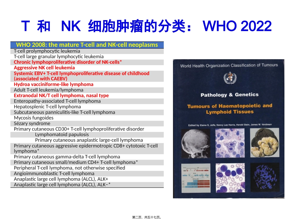 NKT细胞淋巴瘤周剑峰_第2页
