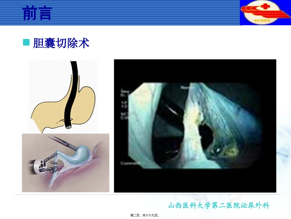 NOTES经自然腔道内镜手术_第2页