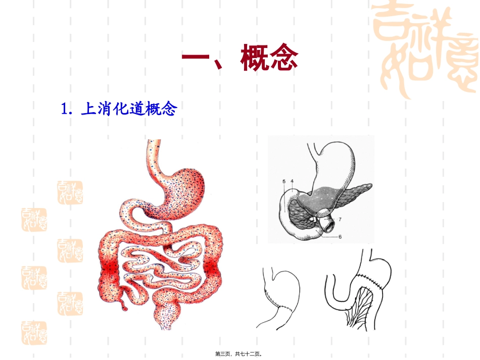 xxxttt上消化道出血_第3页