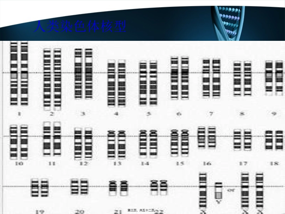 X染色体遗传病_第3页