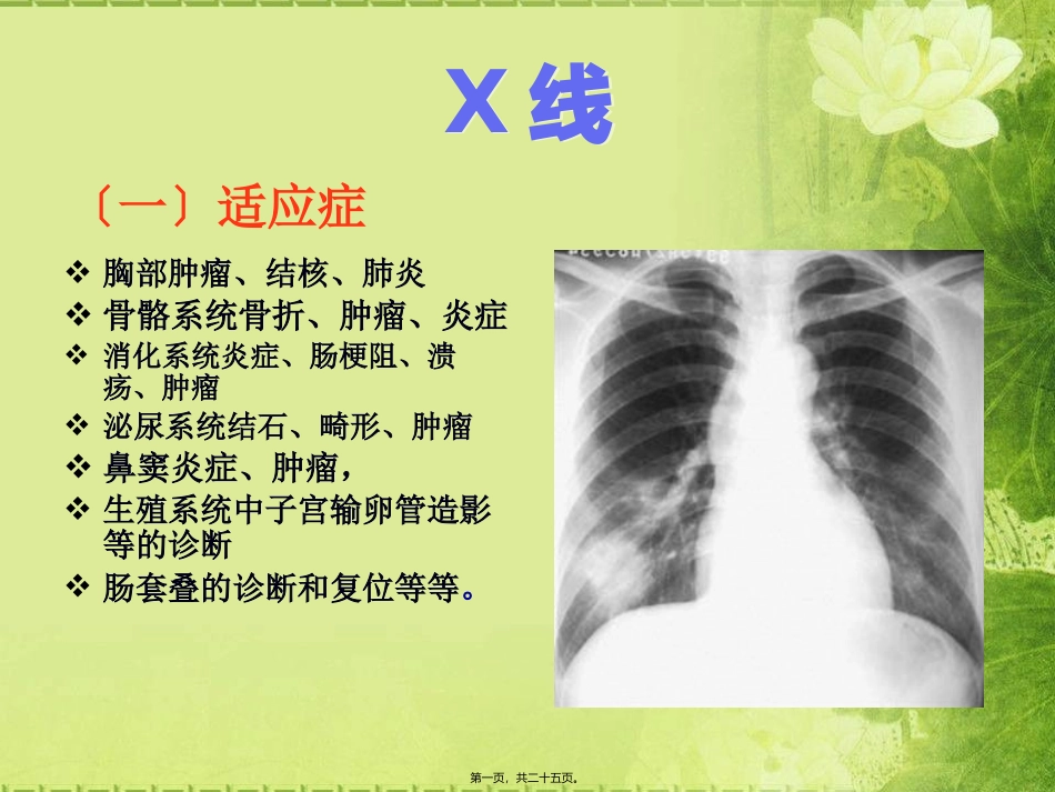 X线CT-DSA--MRI-PETCT-超声的适应症禁忌优势及缺点_第1页