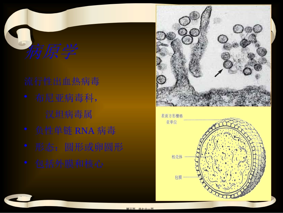 EHF-流行性出血热_第3页