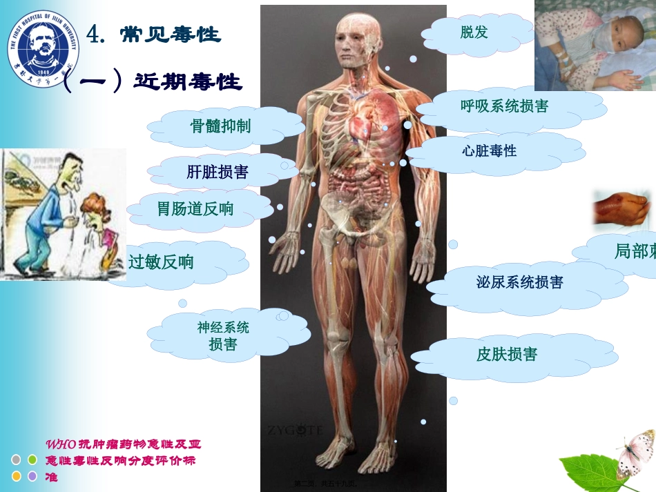 ZCZ-化疗常见毒副反应及处理_第2页