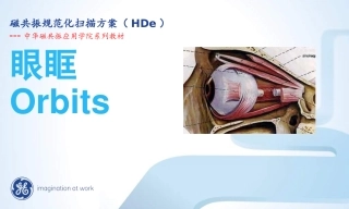09.MRI.眼眶规范化扫描方案