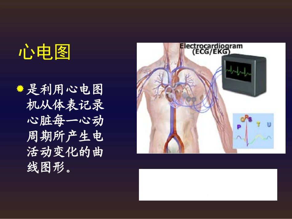 09本心电图汇总_第3页