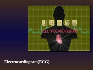09本心电图汇总