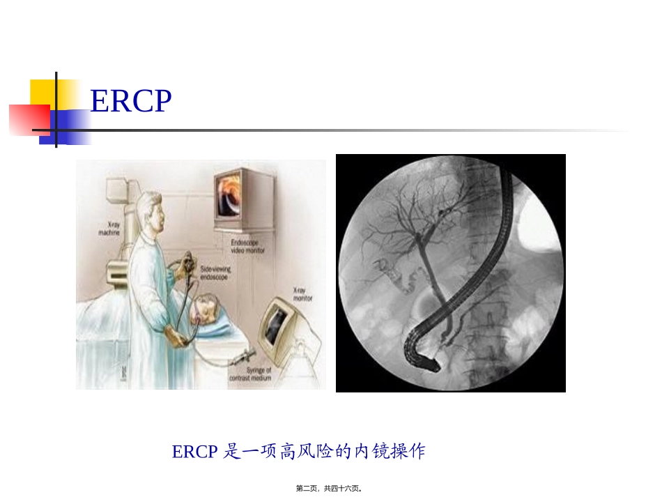ERCP围手术期处理_第2页