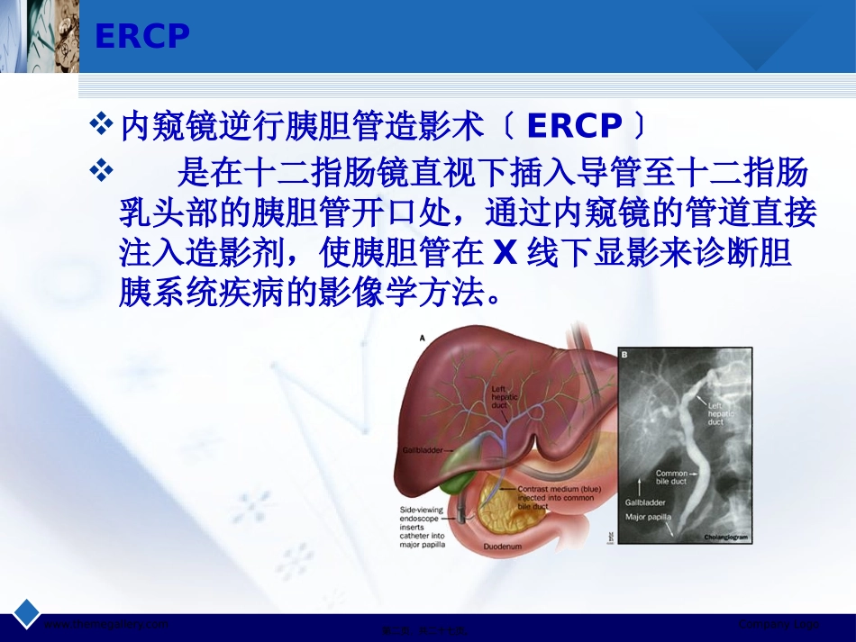 ERCP诊疗与并发症_第2页