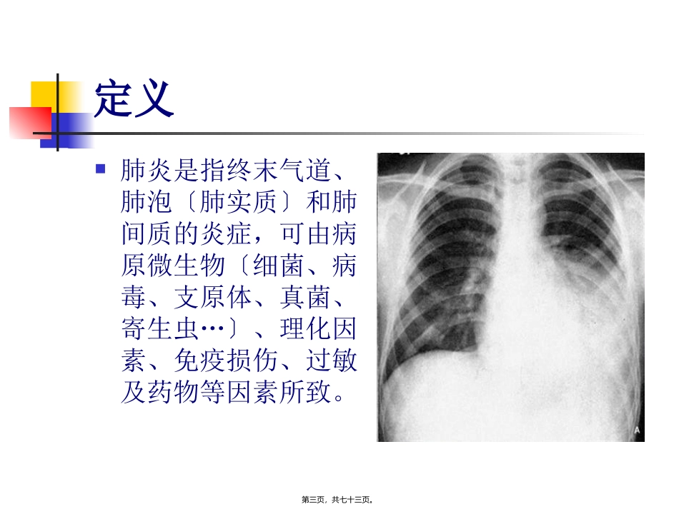 9.肺炎概述_第3页