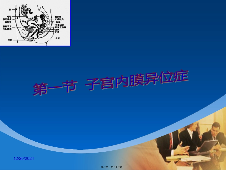 46子宫内膜异位症和子宫腺肌病_第3页