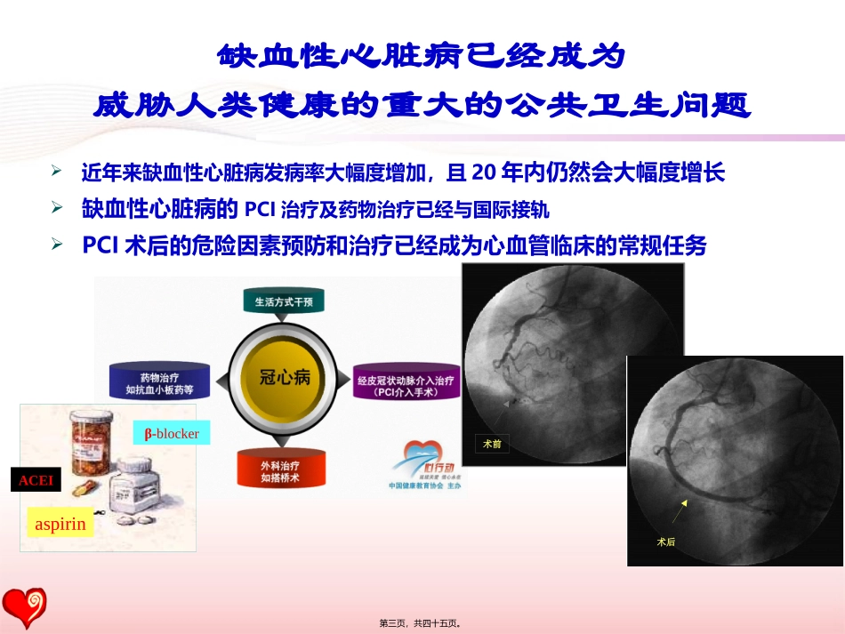 PCI术后患者的心脏康复--指南与现实(2016盛京会)_第3页