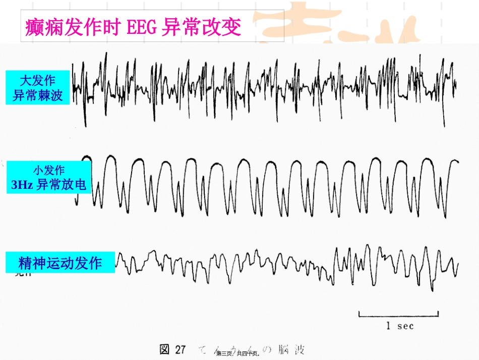 9-抗癫痫药和抗惊厥药本-09_第3页