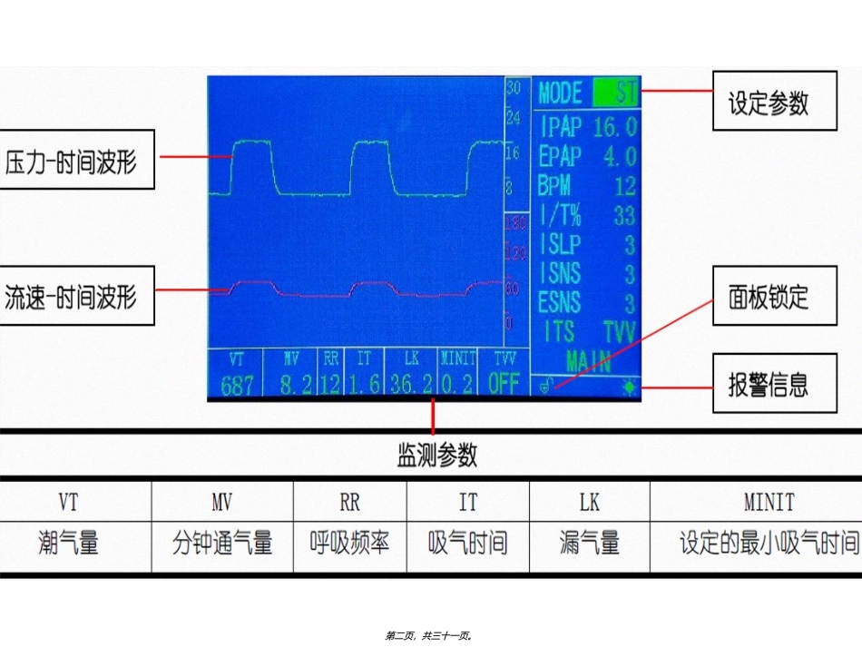 FLEXO无创呼吸机参数调节_第2页