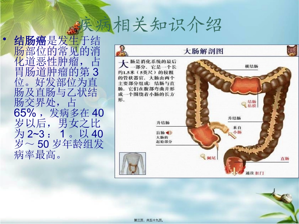 9月-结肠癌概述_第3页