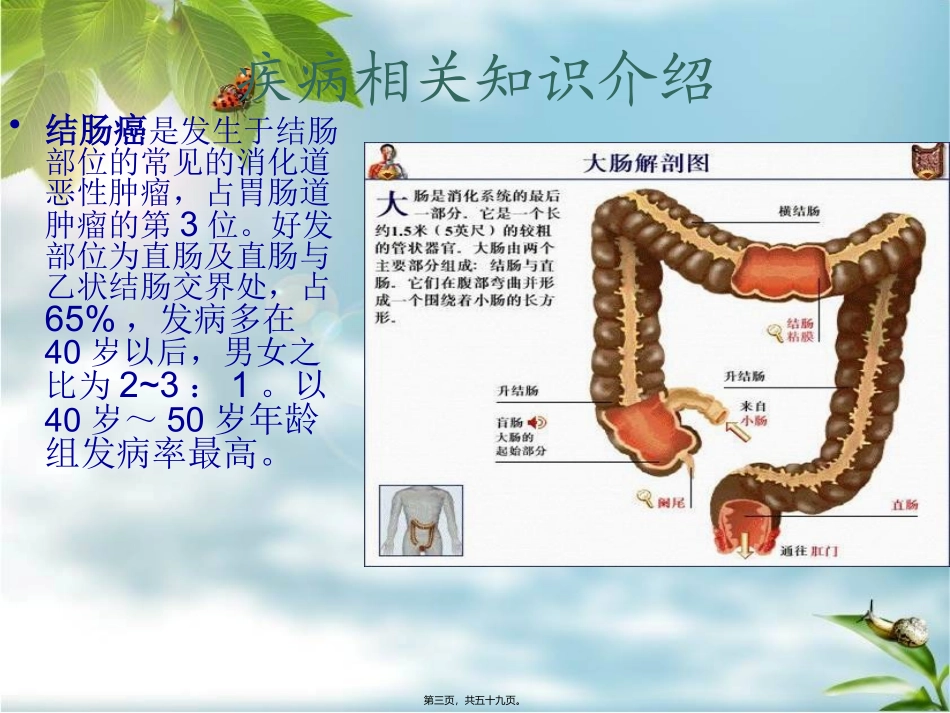 9月结肠癌详解_第3页