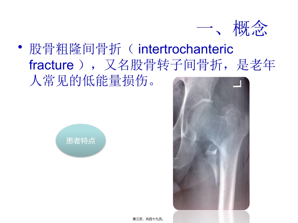 PFNA在股骨粗隆间骨折的应用_第3页