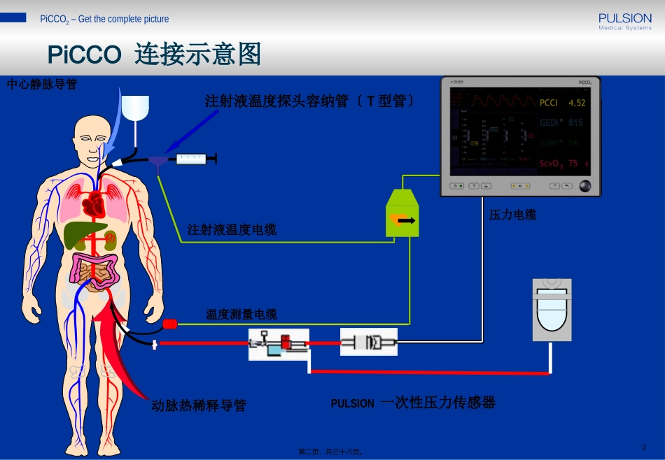 PiCCO参数解读-阜外医院_第2页