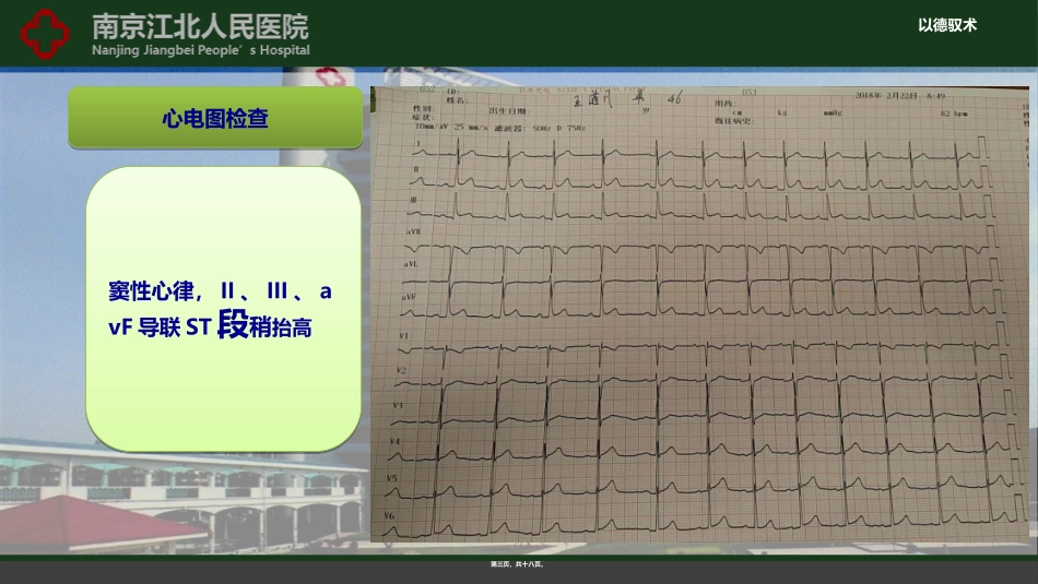 ACS病例讨论_第3页