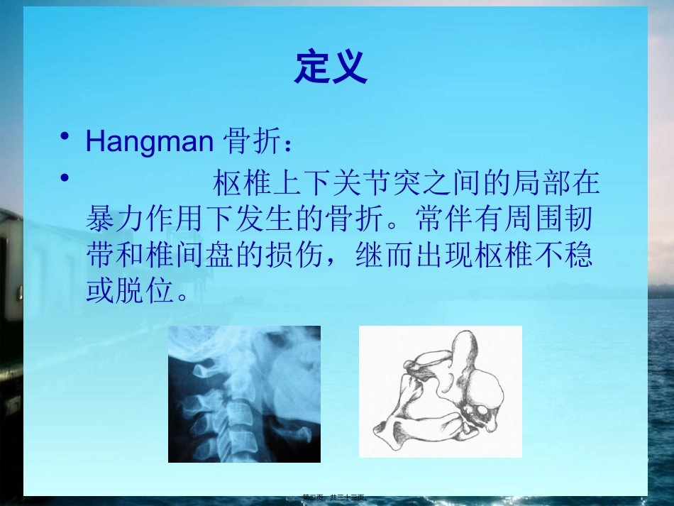 Hangman骨折_第2页