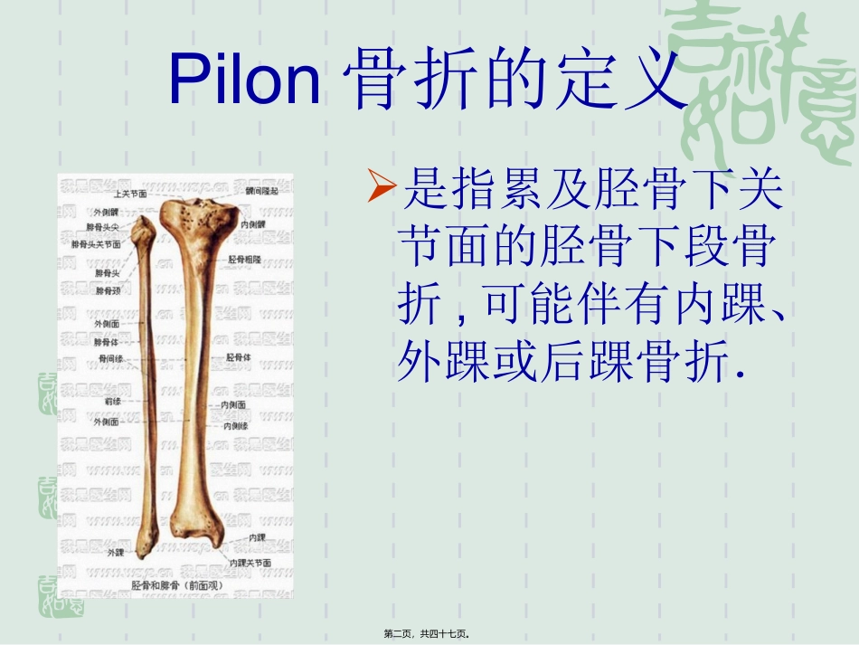 Pilon骨折的诊治现状与进展_第2页