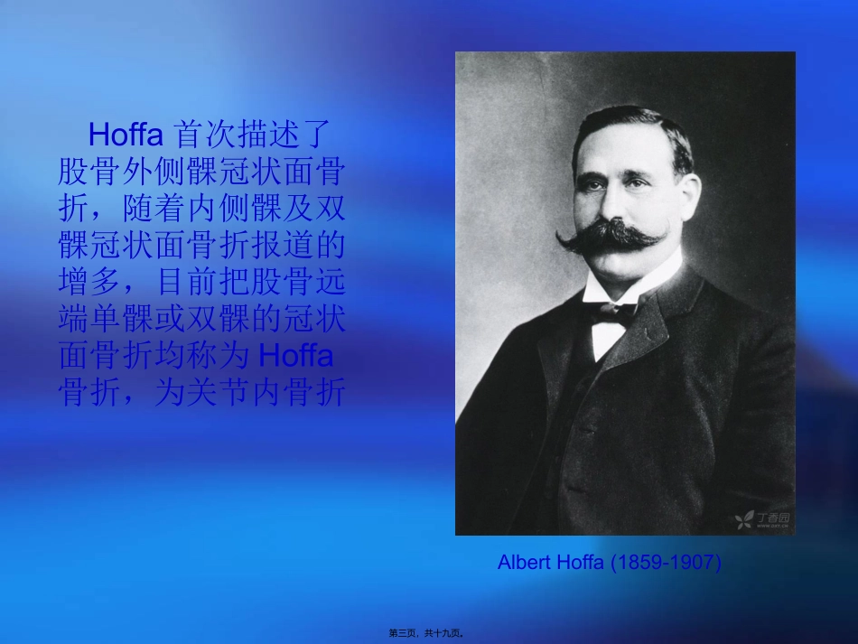 Hoffa骨折_第3页