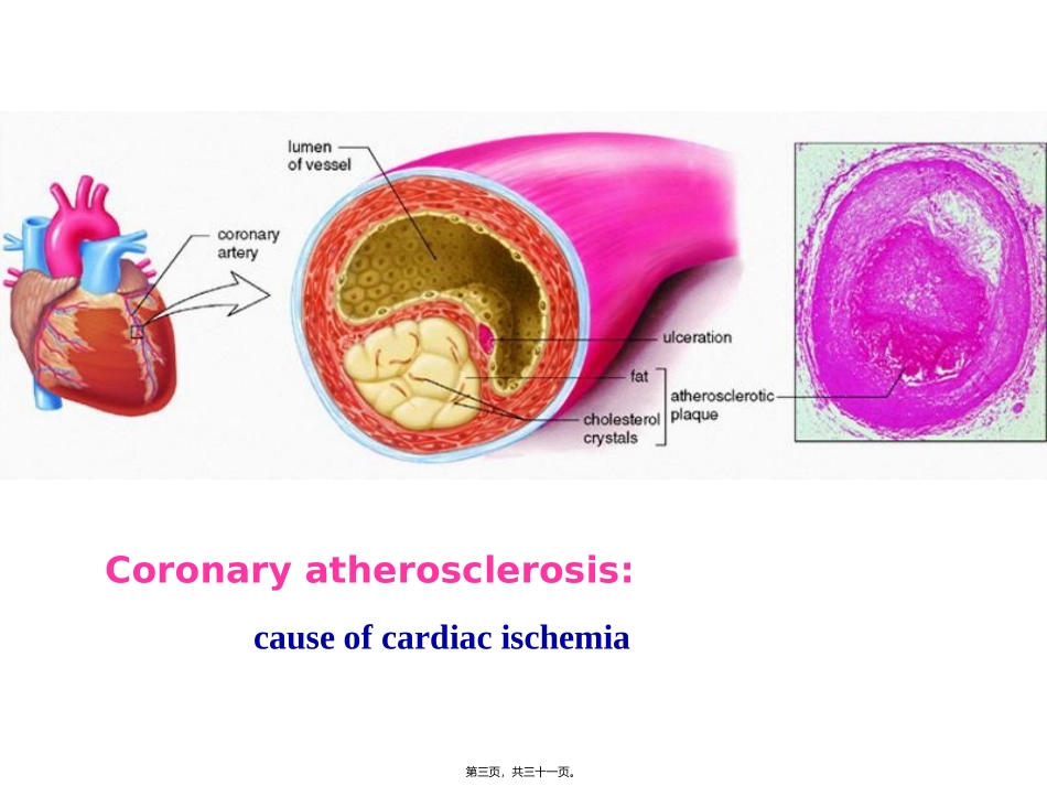 Antianginal-Drugs(抗心绞痛药)_第3页