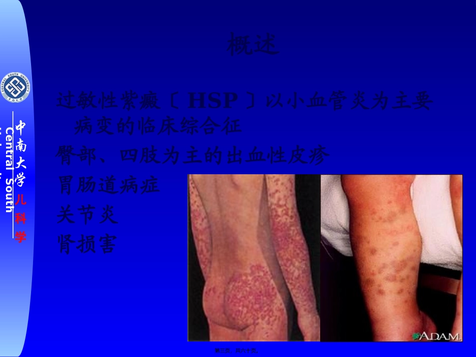 HSP诊治进展_第3页