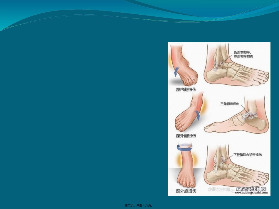 hw----常见损伤的应急处理与急救ppt_第2页