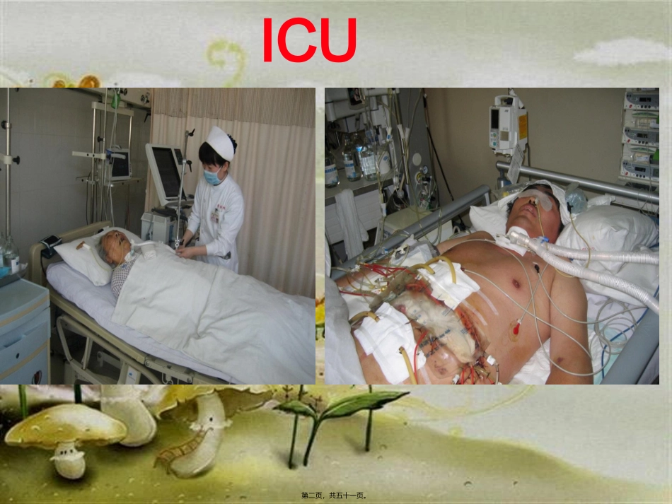 ICU镇痛镇静及谵妄防治_第2页