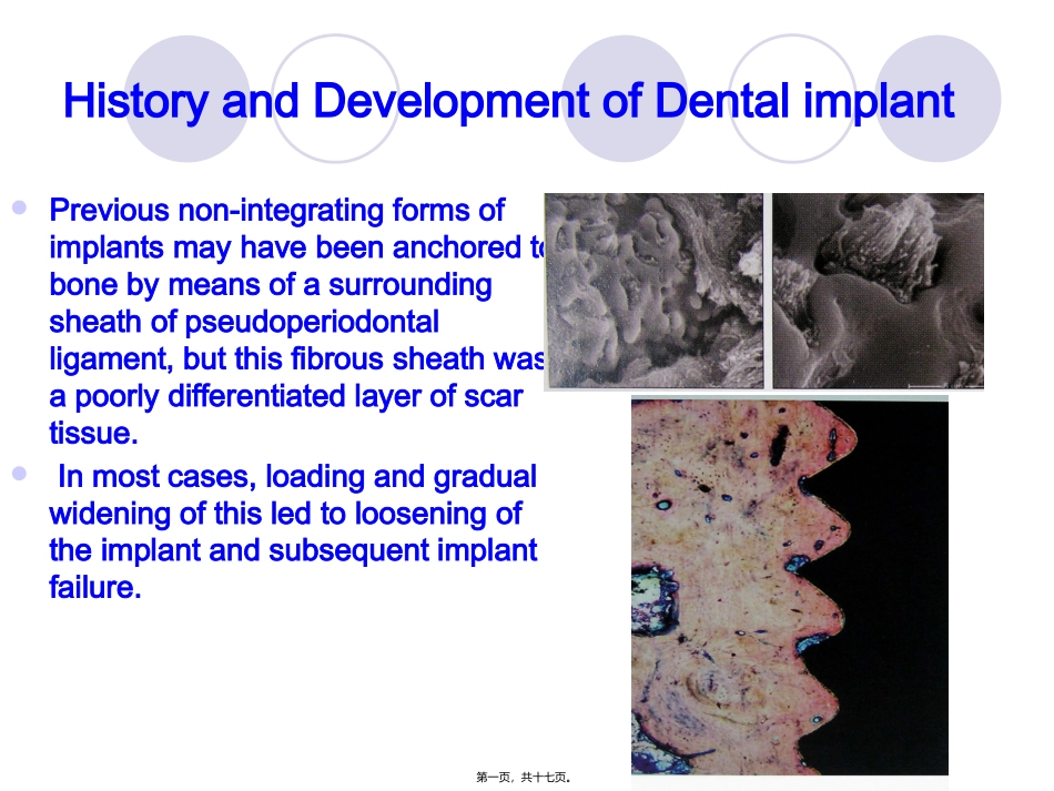 implant-history-and-development-口腔种植_第1页