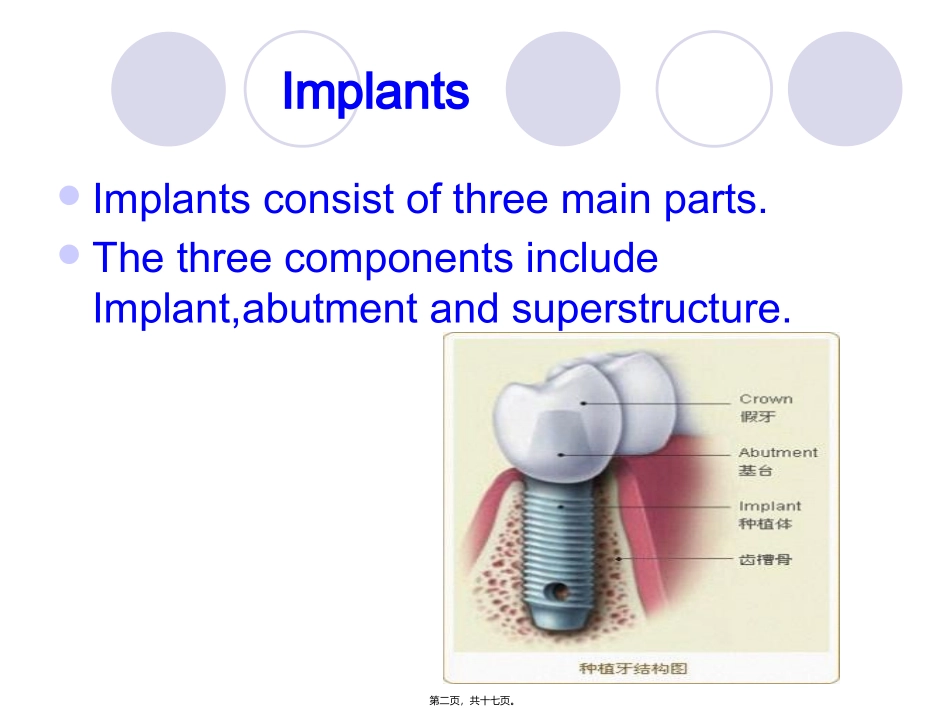 implant-history-and-development-口腔种植_第2页