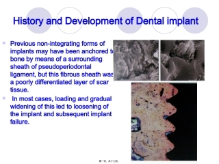 implant-history-and-development-口腔种植