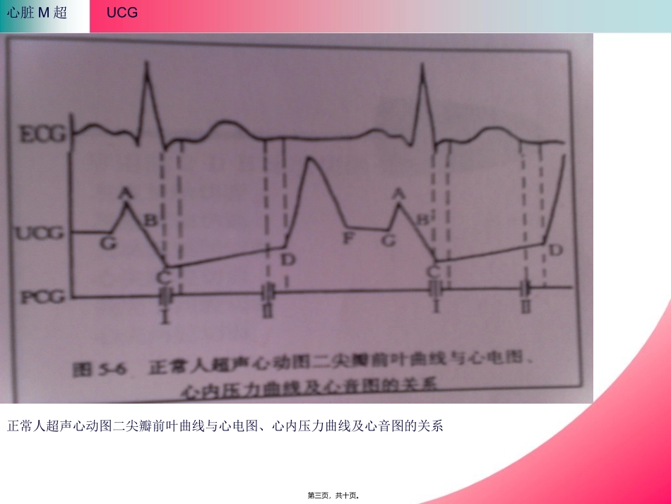 B心脏M超资料_第3页
